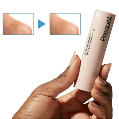 Dermatologist Approved Silicone Scar Refinement Stick